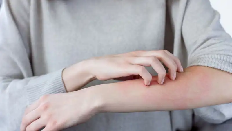 Cilt Kanserinin Sessiz Belirtileri: Dermatologdan Önemli Açıklamalar